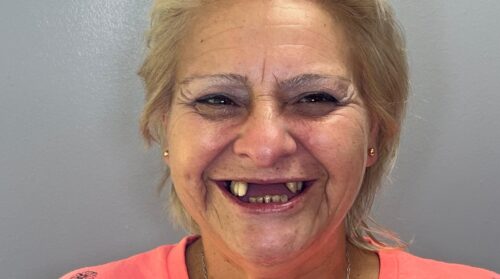Johana antes